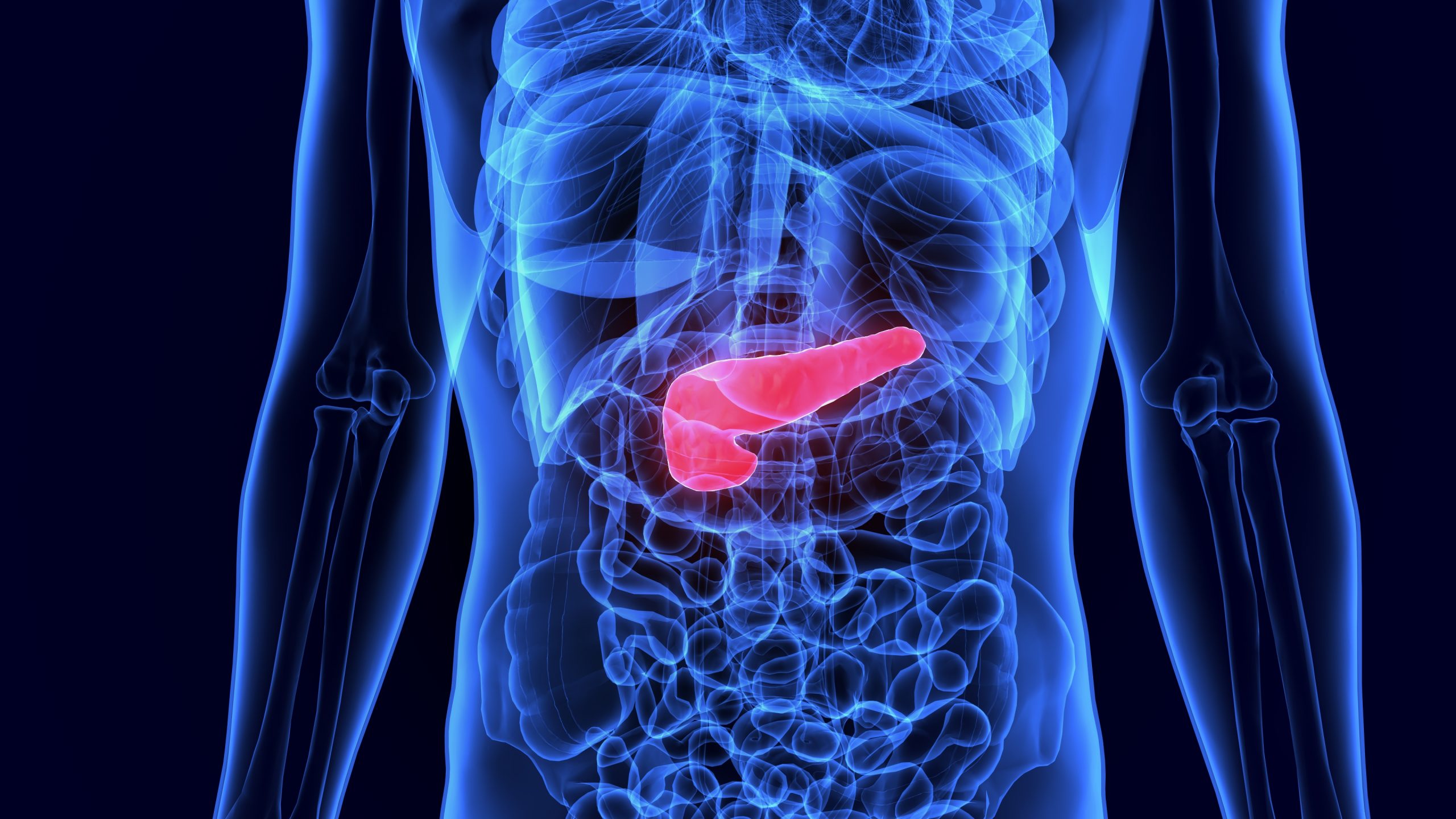 Manifestações clínicas diagnóstico e manejo da pancreatite aguda CUREM